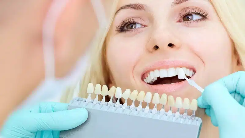 Les différentes options de prothèse dentaire : quelles sont les meilleures ?